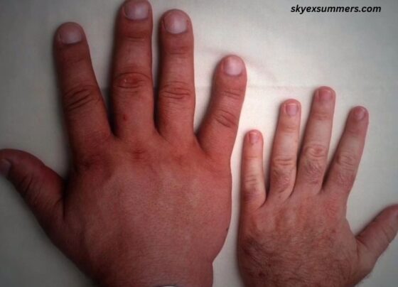 Andre The Giant Hand Size